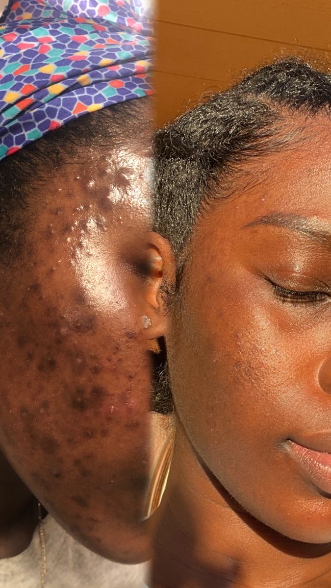 Savon Noir Nigérian Authentique Brut – 100% Naturel & Purifiant – Image 2